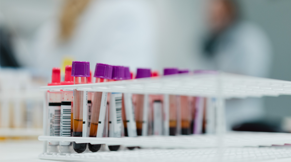 Global PBMC isolations, processing and analyses