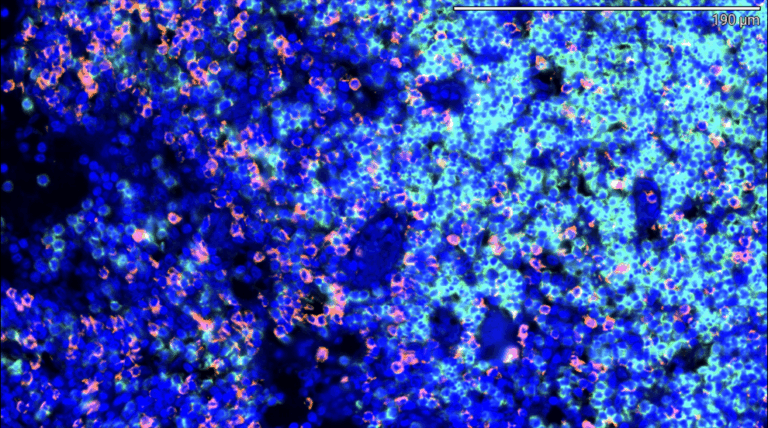 CD4/CD8 Duplex Immunofluorescence