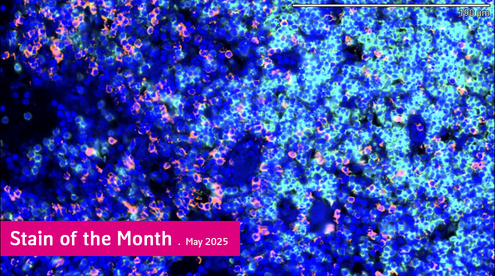 Histology staining in clinical trial research at MLM Medical Labs